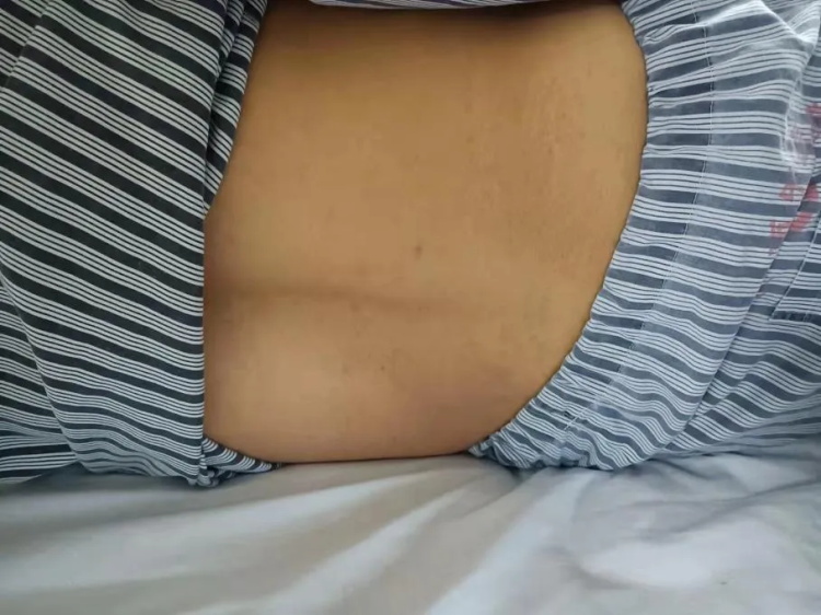 中藥熱奄包技術(shù)（干法）